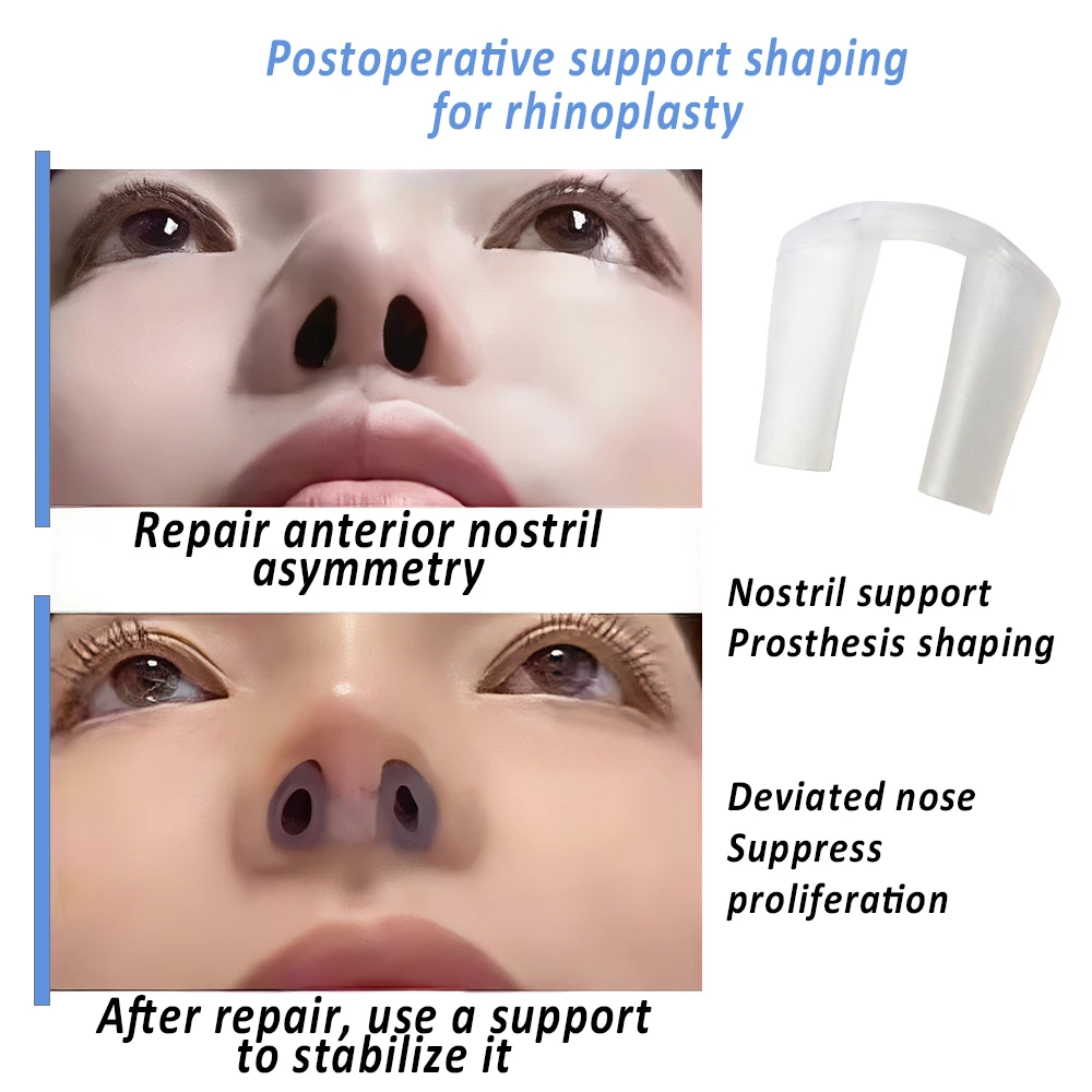 術後鼻形成術用鼻孔サポートシリコン整形矯正器 鼻固定器 シリ - Anti Snore Contour Pillow のレビューと価格